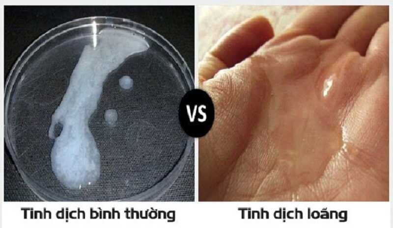 Nhiễm trùng khiến tinh trùng đặc và dính 