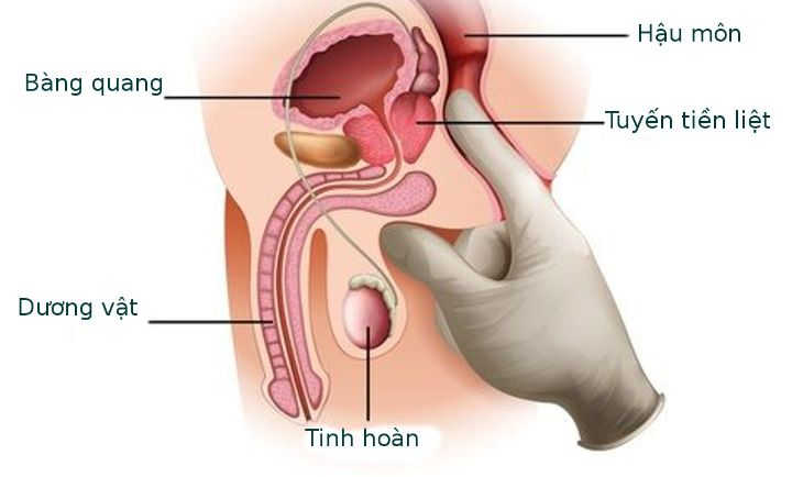 Nhóm thuốc chữa bệnh tuyến tiền liệt