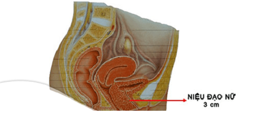 Niệu đạo nữ ngắn