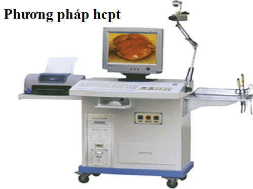 Phương pháp HCPT