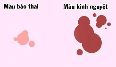 Ra máu báo thai