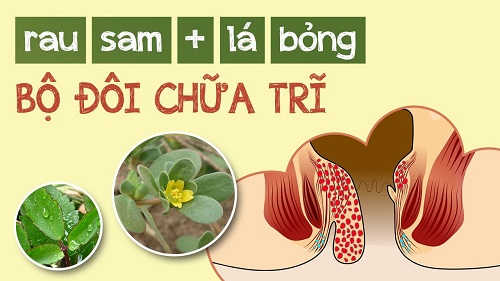 Lá bỏng kết hợp cùng rau sam chữa bệnh trĩ hiệu quả