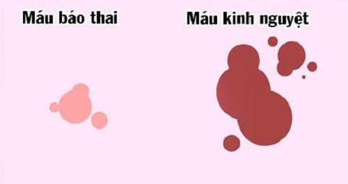 Sự khác nhau giữa máu báo thai và kinh nguyệt