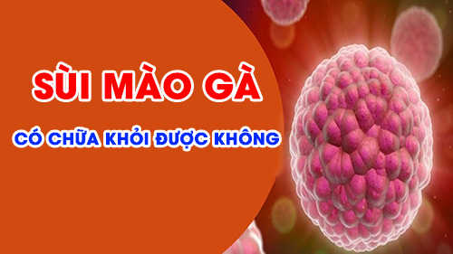 Sùi mào gà có chữa khỏi được không