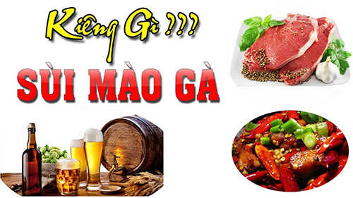 Sùi mào gà nên kiêng gì