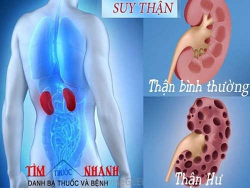 Nhiễm trùng thận, suy thận