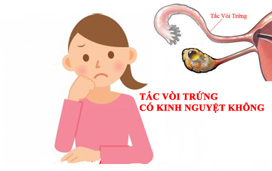 Tắc vòi trứng có kinh nguyệt không