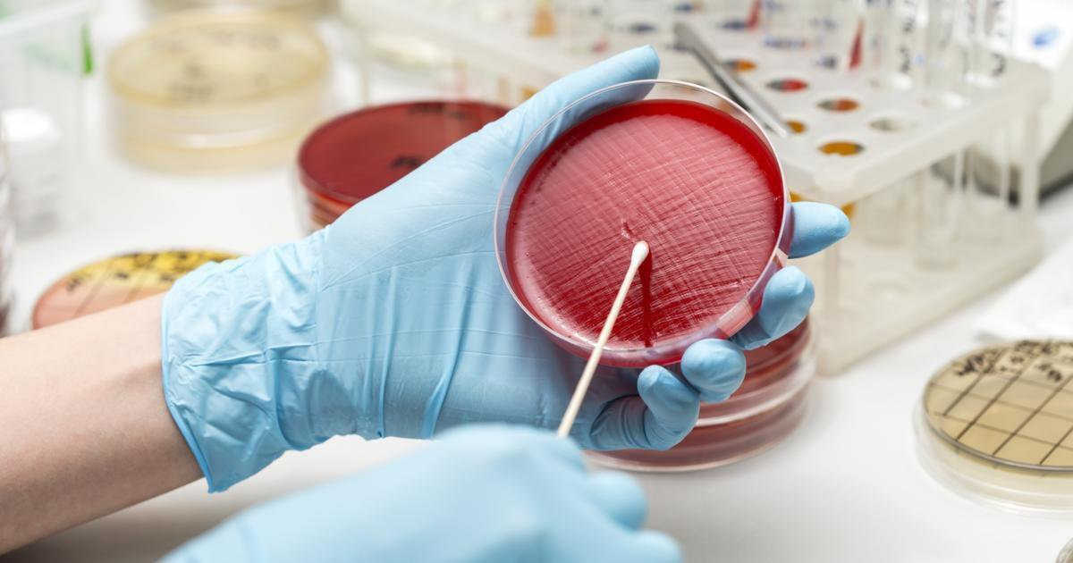 Thời điểm thích hợp đi xét nghiệm để kiểm tra bệnh lậu