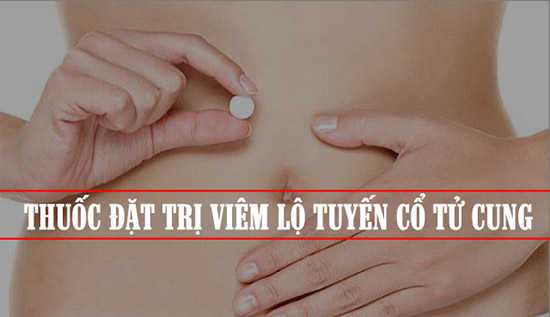 Thuốc đặt viêm lộ tuyến cổ tử cung tốt nhất