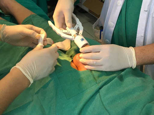 Cách chữa viêm bao quy đầu hiệu quả