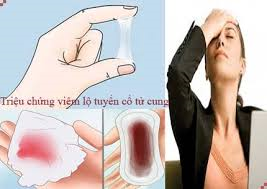 Viêm lộ tuyến cổ tử cung có gây ung thư không 