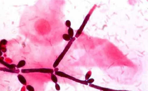 Vi nấm candida albicans