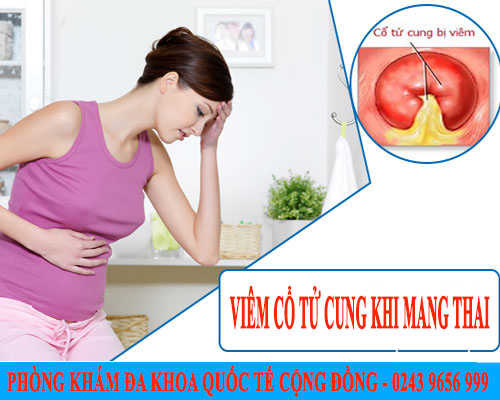 Viêm cổ tử cung khi mang thai