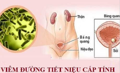 Viêm đường tiết niệu cấp