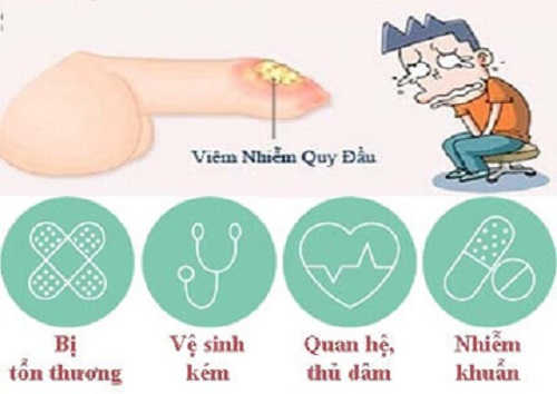 Viêm nhiễm bao quy đầu