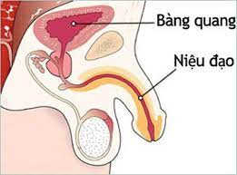 Viêm niệu đạo