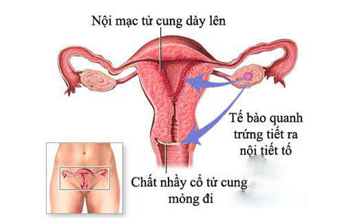 Viêm nội mạc cổ tử cung