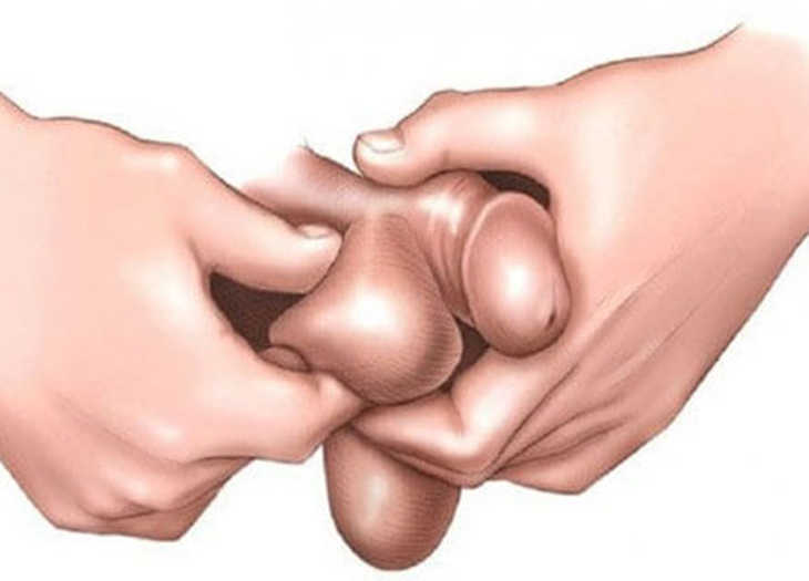 Viêm tinh hoàn mãn tính nguy hiểm như thế nào?