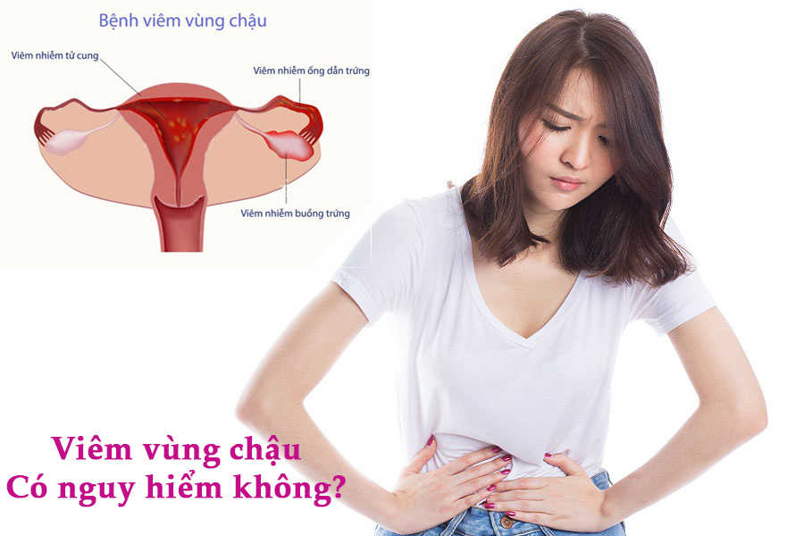 Viêm vùng chậu có nguy hiểm không có gây vô sinh không