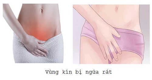 Vùng kín bị ngứa rát