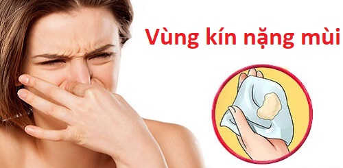 Vùng kín nặng mùi