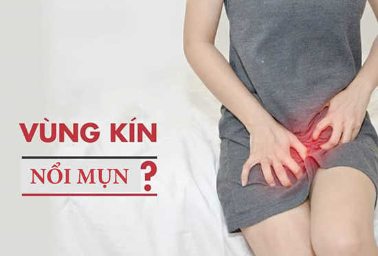 Vùng kín bị ngứa rát và nổi mụn