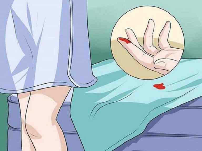 Xuất hiện đốm máu ở vùng kín