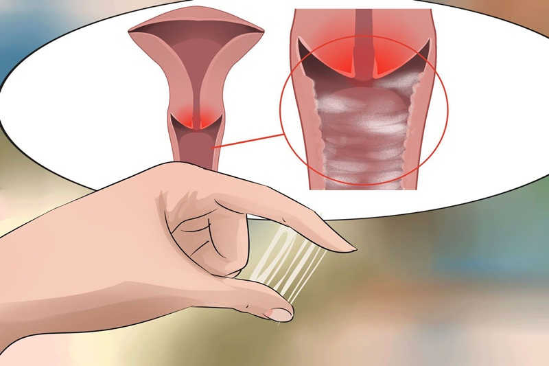 Xuất huyết âm đạo, ra sữa sớm