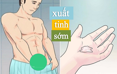 xuất tinh sớm 